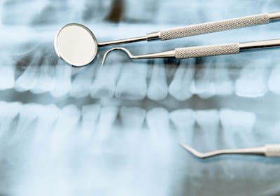 Dental x ray and three dental equipment lying on top of it